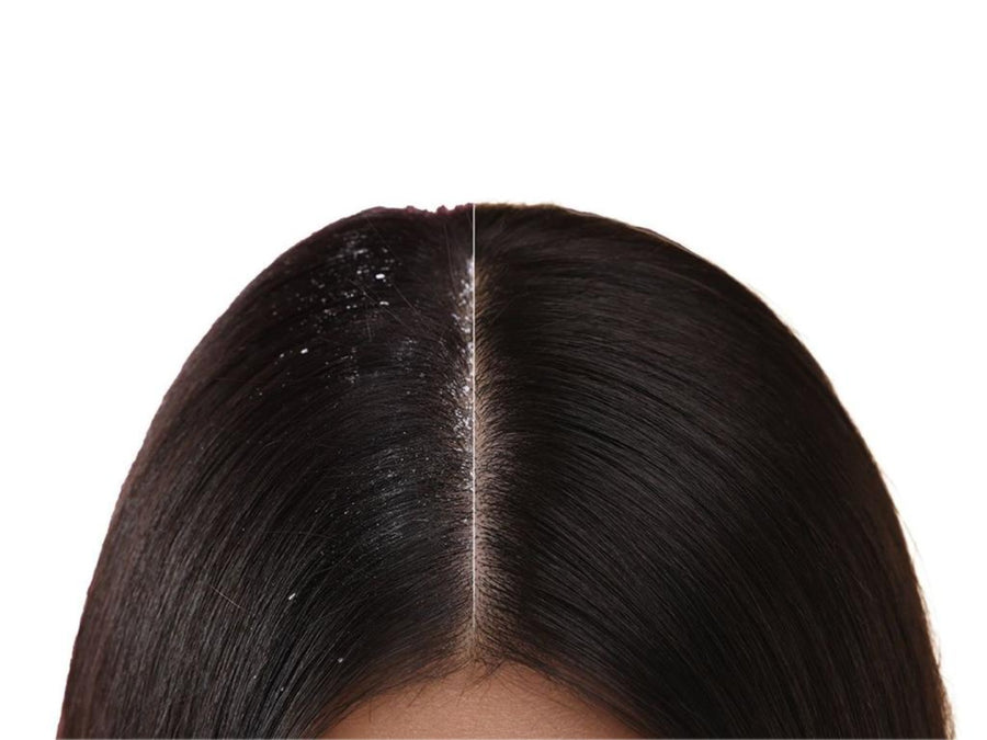 Healthy Hair Starts Below the Surface.