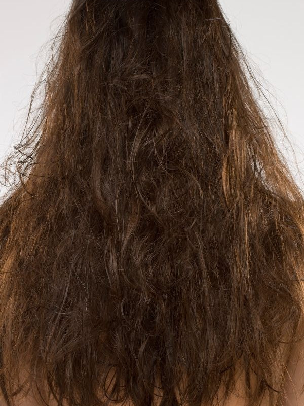 Hair Fall