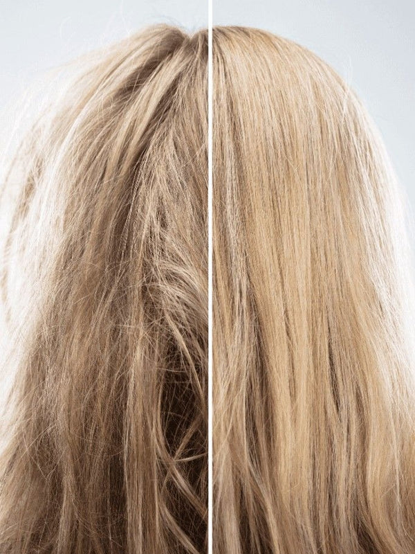 Hair Fall